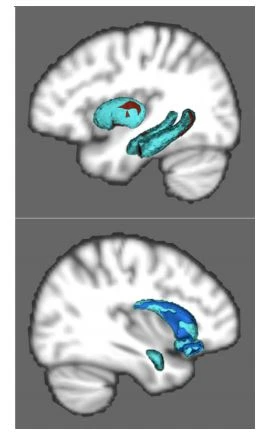 Shape analysis reveals
