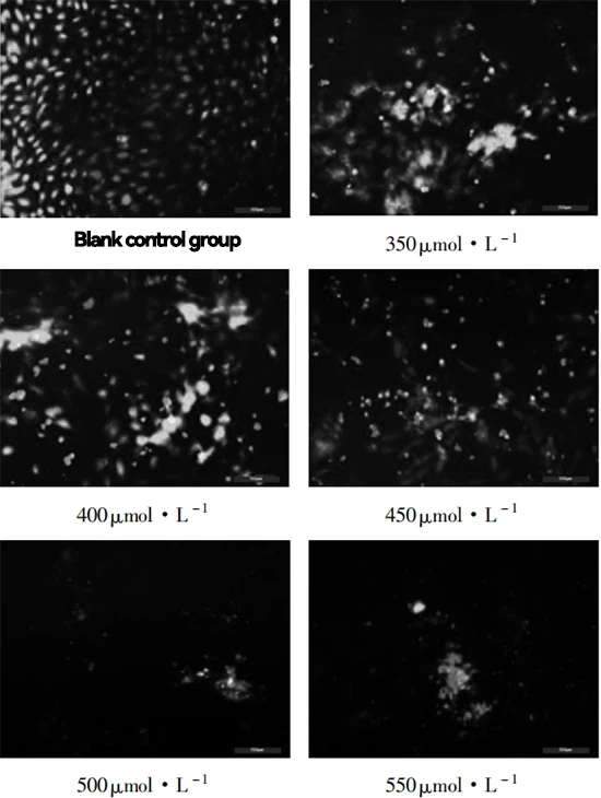 Fig. 2 AO/EB staining of rabbit RTECs treated by different concentrations of H2O2 ( 100 × )